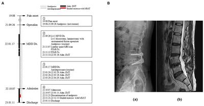 Graded exercise with motion style acupuncture therapy for a patient with failed back surgery syndrome and major depressive disorder: a case report and literature review